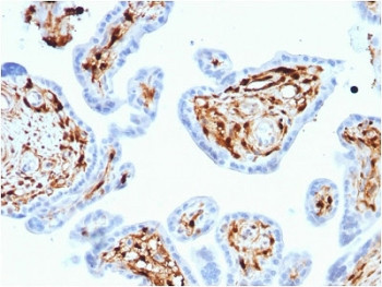 Anti-S100A4 / FSP1, clone CPTC-S100A4-3