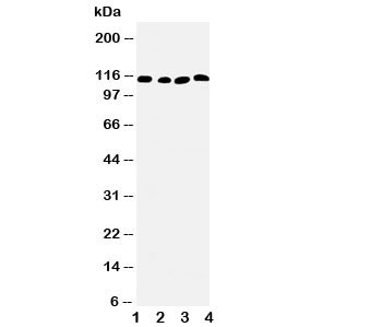 Anti-SERCA2 ATPase