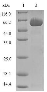 Aldo-keto reductase family 1 member C3 (AKR1C3), human, recombinant
