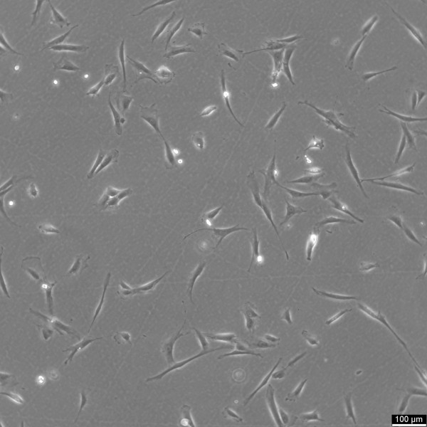 imWilms1 Cells