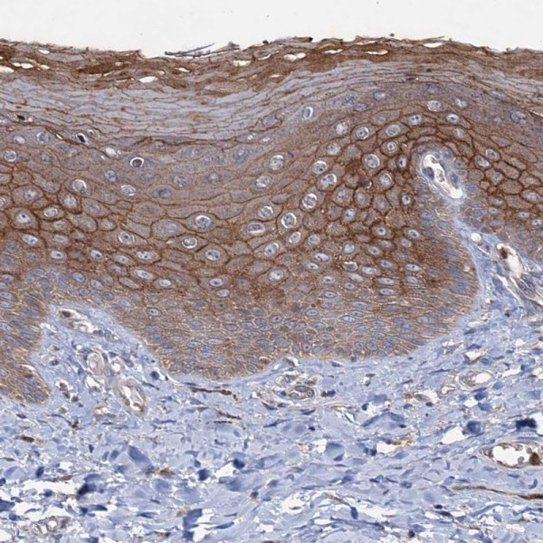 Anti-PTPN3