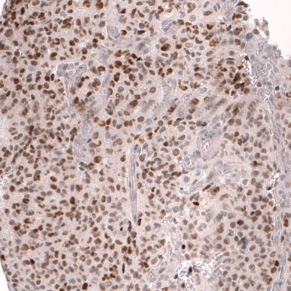 Anti-ABCB5, clone CL13589