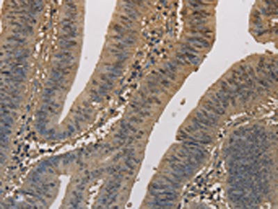 Anti-ELOVL1