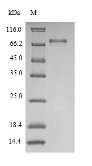 Tyrosine-protein kinase Lck (LCK), human, recombinant