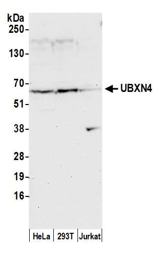 Anti-UBXN4