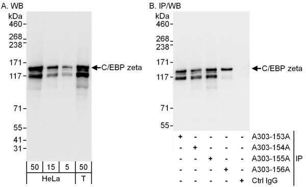 Anti-C/EBP zeta