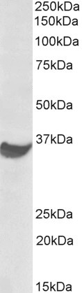 Anti-PD-L1 / CD274