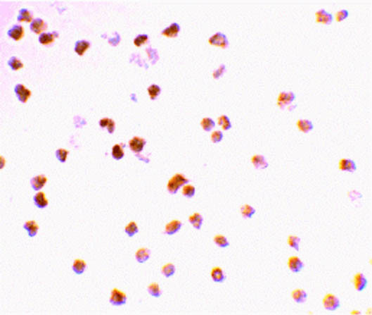 Anti-TLR7 (Toll Like Receptor-7)