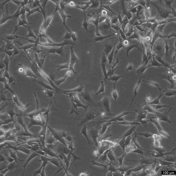 GIMEN Cells