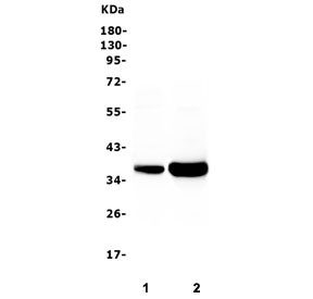 Anti-TNNT3