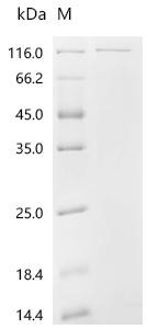 Proliferation marker protein Ki-67 (MKI67), partial, recombinant human