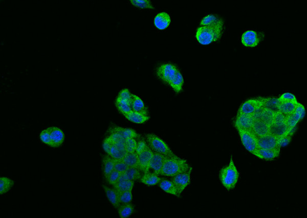 Anti-DR5/TRAIL R2 Monoclonal Antibody