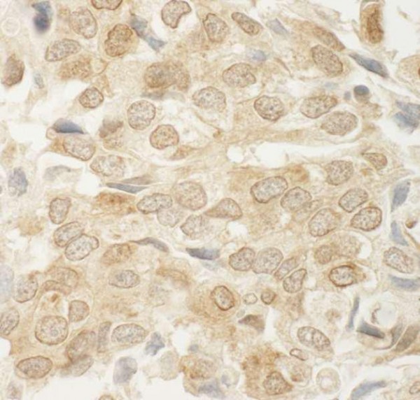 Anti-MED15 (IHC)