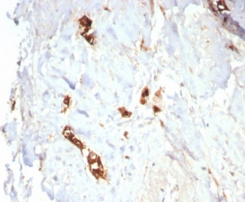 Anti-Mammaglobin A / SCGB2A2, clone MGB/7980R