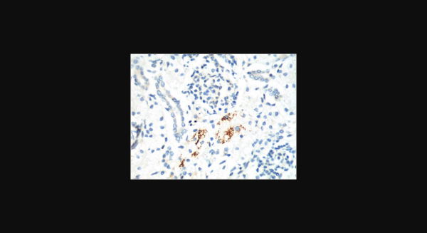 Anti-Kif 7, monoclonal
