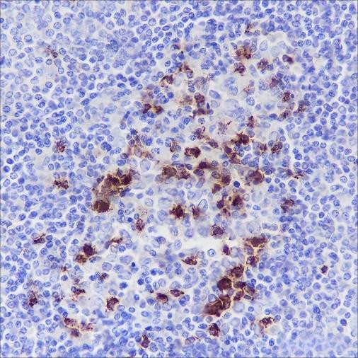 Anti-Recombinant PD1, clone A115