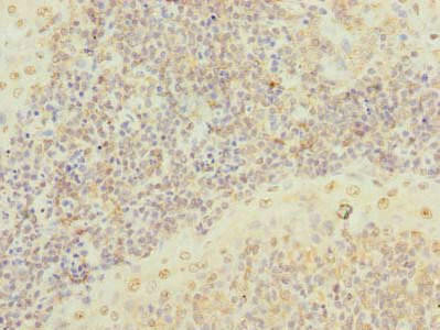 Anti-SCRG1