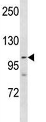 Anti-PARP1