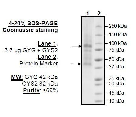 GYG/GYS2 Complex