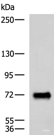 Anti-PPEF1