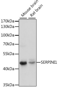 Anti-SERPINI1