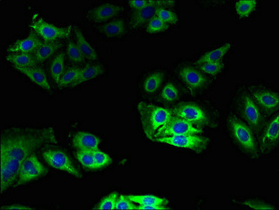 Anti-CYB5A