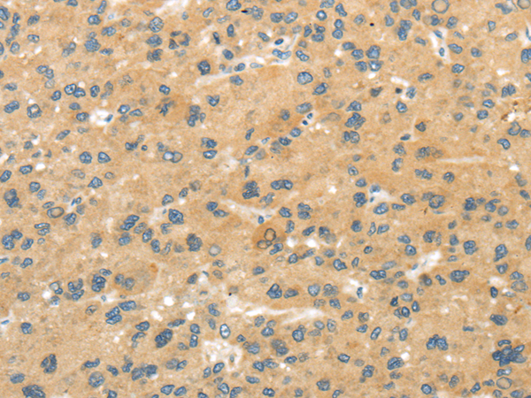 Anti-MPP6