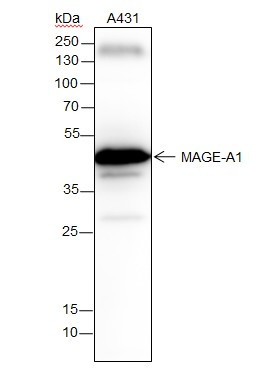 Anti-Recombinant MAGEA1, clone A293