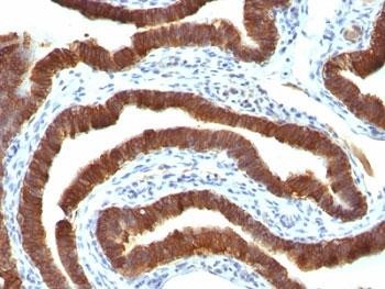Anti-Cytokeratin 19 (CK19, KRT19), clone Ks19.1