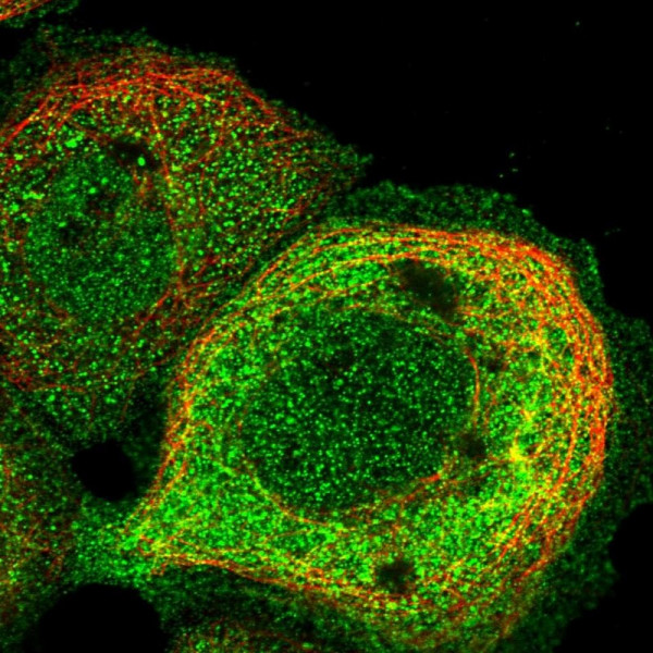 Anti-TRPM4