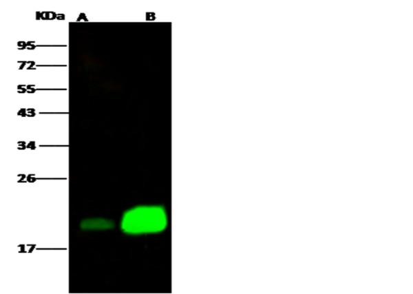 Anti-NPC2 Monoclonal Recombinant Antibody