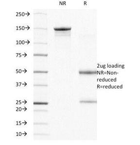 Anti-Integrin Beta-4, clone UM-A9