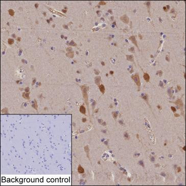 Anti-ELAVL2