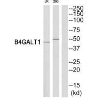 Anti-B4GALT1