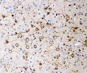 Anti-Neurofilament 200 (Heavy), clone N52