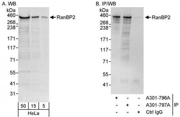 Anti-RanBP2