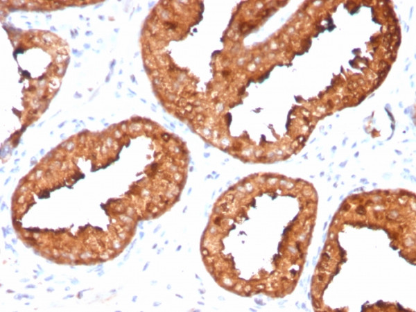 Anti-Prostate Specific Antigen (PSA), recombinant antibody, clone KLK3/4551R