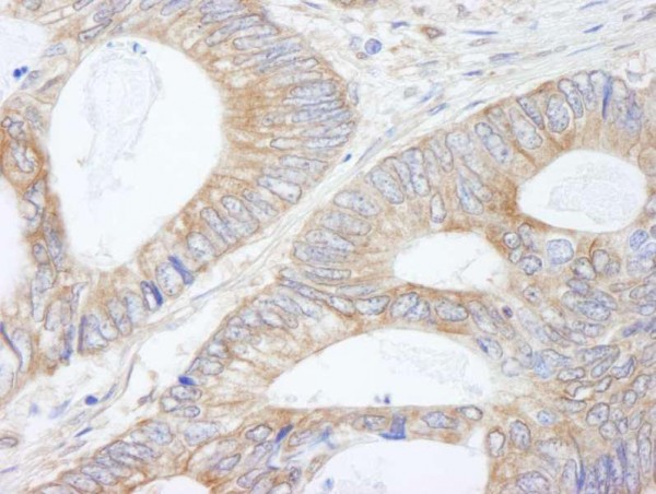 Anti-CIP2A (IHC)