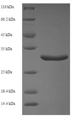 Calmodulin-like protein 5 (CALML5), human, recombinant