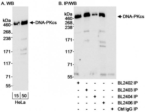 Anti-DNA-PKcs