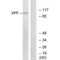 Anti-ERCC4