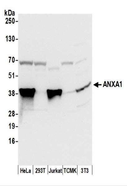 Anti-ANXA1/Annexin A1
