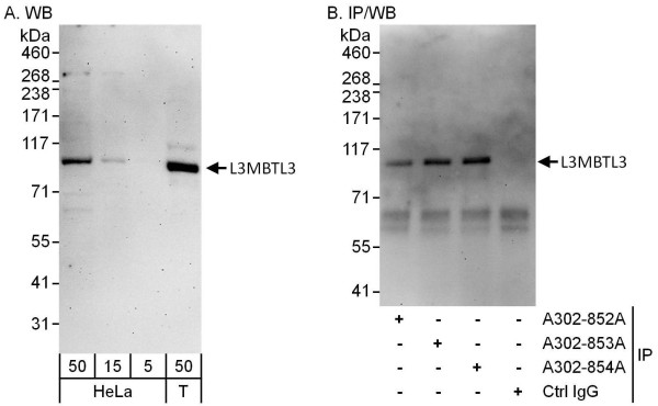 Anti-L3MBTL3