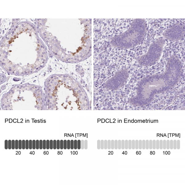 Anti-PDCL2