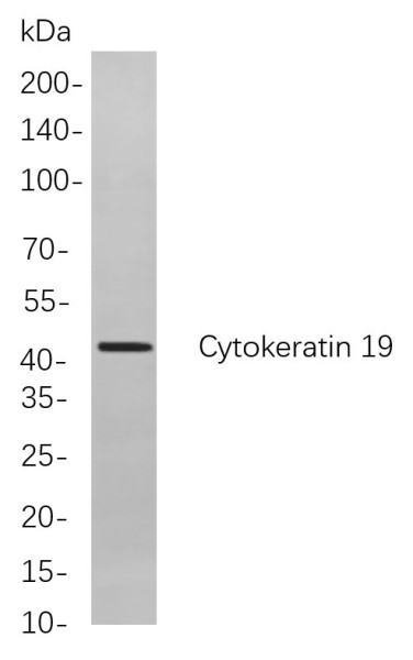 Anti-Recombinant Cytokeratin 19, clone 9A4