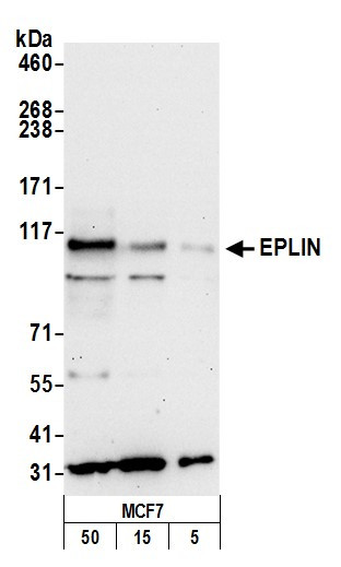 Anti-EPLIN
