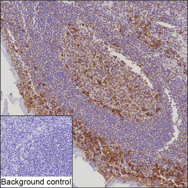 Anti-CD27