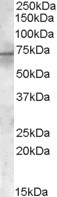 Anti-PDK1, Internal