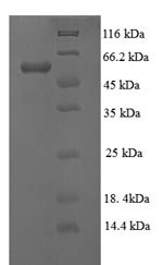 Lysyl oxidase homolog 1 (LOXL1), partial, human, recombinant