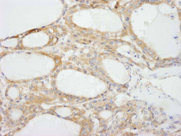 Anti-NF2 (IHC)